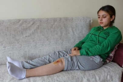 16 yaşındaki Özge köpeklerin saldırısında yaralandı!